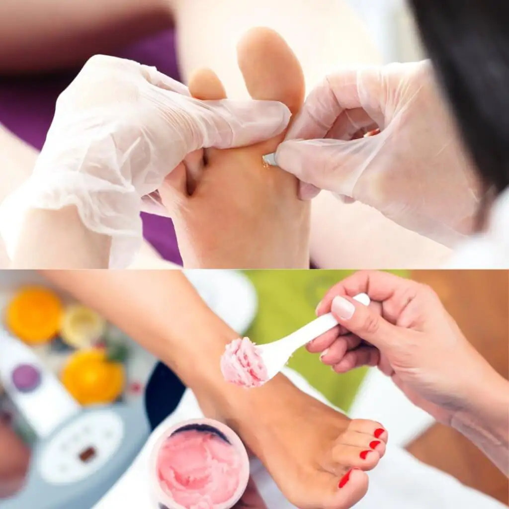 Foto - Pedicure Curativo